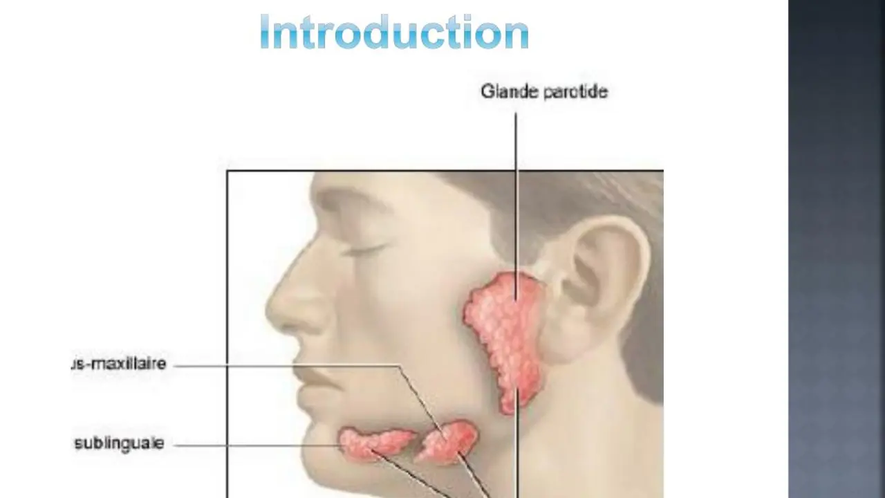 Sjogren's Syndrome and Dry Mouth: What You Need to Know